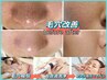 ≪鼻・頬毛穴の開きが気になる方≫リピート率90％以上夏の緊急ケア/￥9,800→