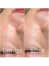 サロン ド ブラン アオヤマ(Salon de BLANC AOYAMA)/