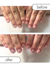 ピノ(pino)/◆深爪矯正＋自爪風仕上げ◆