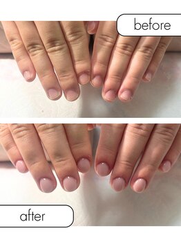 ピノ(pino)/◆深爪矯正＋自爪風仕上げ◆