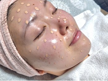 マールム(MALUM)の写真/仙台上陸！肌色、仕込む時代。隠すより育てるメソスキンカラーは大人の疲れ肌をファンデいらずの土台に