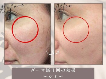 整骨院トリデ(整骨院TORIDE)/シミ