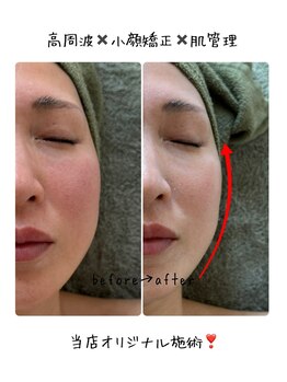 ビオン 松戸(bion)/当店オススメ施術