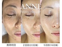 アンネ ビューティー クリニーク(ANNE BEAUTY CLINIQUE)の雰囲気(最先端機器/近赤外線/血行/自律神経/リンパ/毛髪ケア/バストケア)