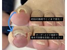 初回施術で変化を実感!