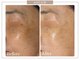 ロイヤル(ROYAL)の写真/至近距離でも自信。40代からの本気美白ケア。シミ・くすみをケアして明るく透明感溢れるお肌へ導きます。
