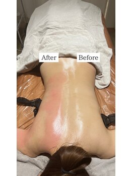 サロン ド モナ(salon de mona)/【ビフォーアフター】