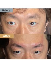 眉毛ハウス 吉祥寺店(眉毛HOUSE)/お客様の施術例(吉祥寺/東京)