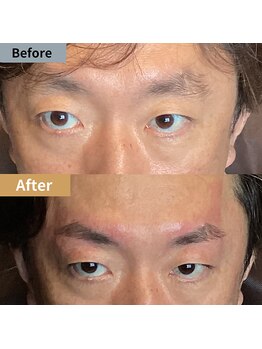 眉毛ハウス 吉祥寺店(眉毛HOUSE)/お客様の施術例(吉祥寺/東京)