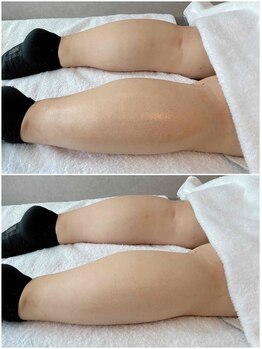 グリッタープラス(glitter plus)/フットマッサージ