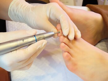 ドクターネイル爪革命 札幌本店/メニュー2 トータルフットケア