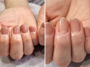 ジェルネイル/深爪