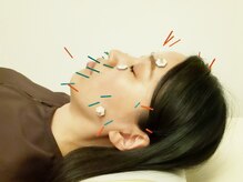 はり灸心音