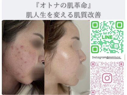 ミミルーチェ(mimiluce)の写真