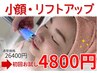 【ダウンタイム無し!リフトアップ】顔のたるみ改善して理想の小顔に♪4800円