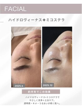 ミミ(mimi)/半年後の変化