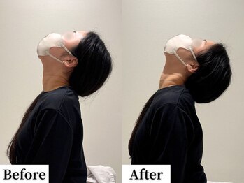 ソレア(Solea)/首こり改善1回目