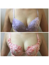 ロータス(Lotus)/40代　(上)ビフォー(下)アフター