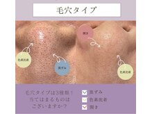 レイ エステティック 江南店(RAY ESTHETIC)/毛穴洗浄×顔脱毛