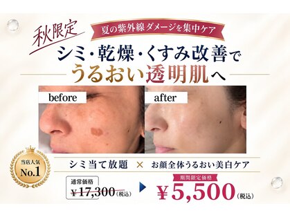 パールホワイトニングサロン 小田原店の写真