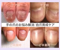 リケアネイル(Re:care nail)