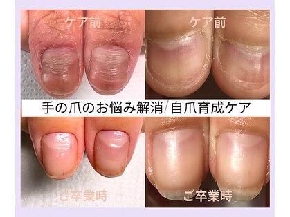 リケアネイル(Re:care nail)の写真