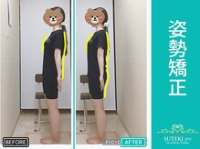 美骨矯正 ステキプロ(SUTEKI pro)/腰痛・肩こり・姿勢改善