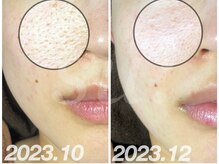 スウ(su:)/2ヶ月後には…☆