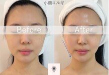 ルナビューティー 赤坂(LUNA beauty)