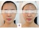 ルナビューティー 赤坂(LUNA beauty)の写真