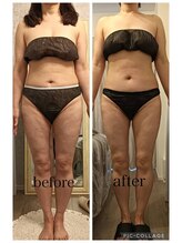 リープ(Lieb)/ボディビフォーアフター