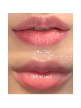 ゲンキー(genkey)/