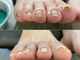 エヌド ネイル(n°nail...)の写真/フットケアを始めるなら今！【ヘイスイッチ】ジェル巻き爪ケア◎ご新規様価格1本￥3300→2500！

