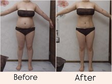 エステティックサロン ルテラ