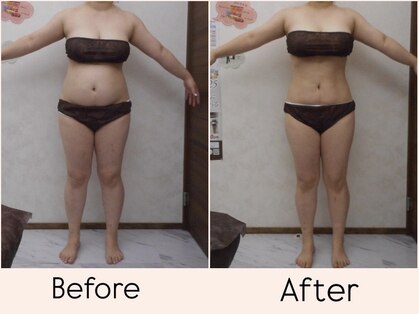 エステティックサロン ルテラの写真