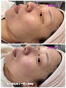 アモ(amo)/クリスティーナ アンストレス