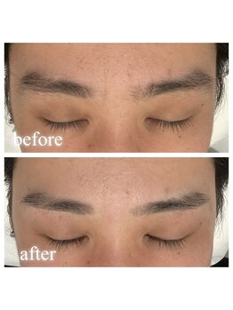 リノア(Linoa)/メンズ眉毛デザイン脱毛