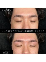 ユー 千葉駅前店(you)/ビフォ－アフター写真