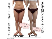 ギンザ ペルヴィア(GINZA PELViA)の雰囲気（スッキリ小顔に！）