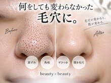ビューティービューティー(beauty×beauty)