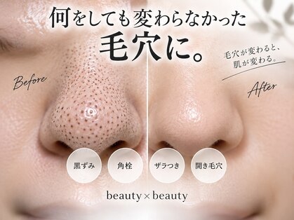 ビューティービューティー(beauty×beauty)の写真