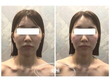 美極 銀座店/銀座/小顔コルギ/小顔矯正