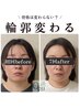 【ご新規様限定】小顔頭蓋骨矯正＋リンパケア8回￥61600→￥41600吉岡店限定