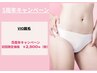 5周年キャンペーン　VIO脱毛