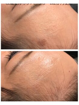 エリール(elire)/核酸DNAミネラル酵素ケア