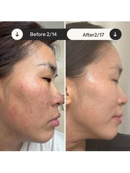 ラ ムーン アイラッシュアンドヘアメイク(La.Moon)/ルネセル化粧品