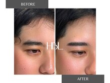 グリーム(GREEM)/メンズHBL