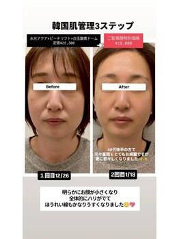 クレール 小山店(CLAIR)/【韓国定番3STEP】