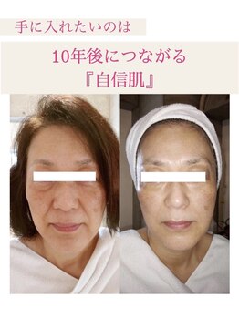 フワリィ(Fuwaly)/エイジングケア