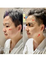 ビードット バイ ソーフライ(B.by So fly)/男性の小顔は好印象◎男の美顔☆